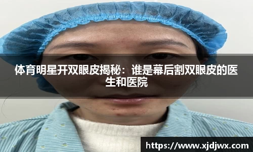 体育明星开双眼皮揭秘：谁是幕后割双眼皮的医生和医院